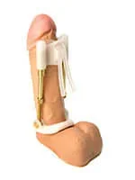 The Size Matters Penis Enlarger